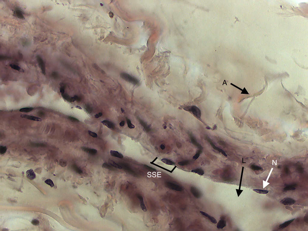 Mammal Artery Vein and Nerve Simple Squamous Original 40x Histology